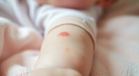 baby eczema flare management